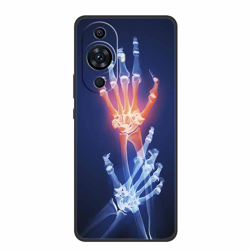 جراب سيليكون لين لهاتف هواوي ن - مراجعة Huawei Nova 12 وسعره